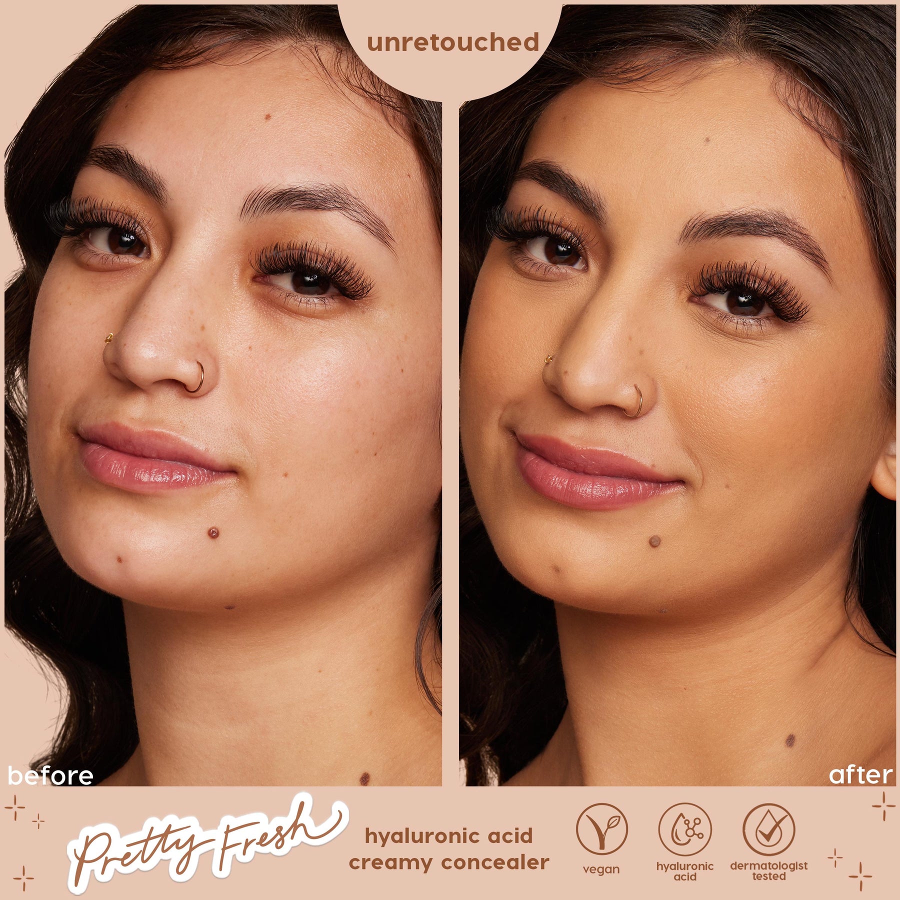 Medium 100 W - Home Choice